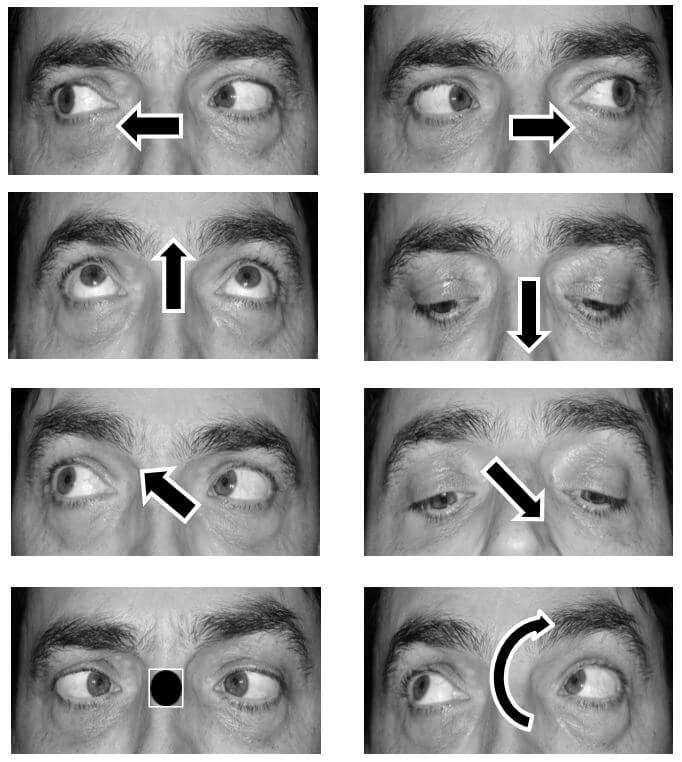 Eye yoga for glaucoma patients? - VELUX STIFTUNG